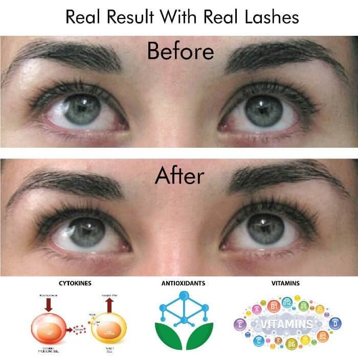 Before and after using MD Lash Factor 6-month serum showing real, longer, thicker lashes with key growth ingredients
