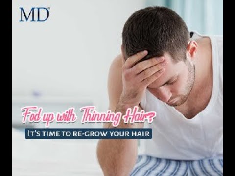 Distressed male model showing thinning hair, expressing concern and urgency—time to regrow hair with advanced hair loss solution.