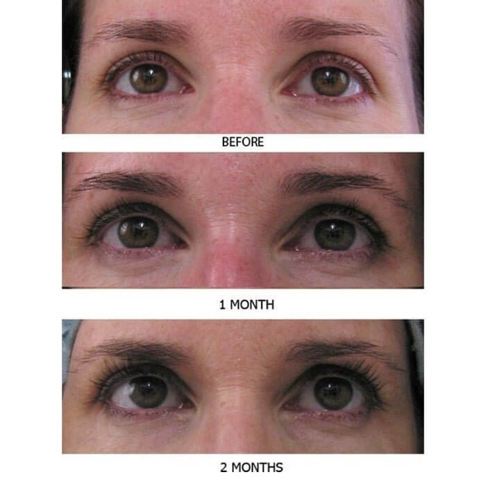Progressive lash growth results from MD Lash Factor: before use, after 4 weeks, and optimal length at 8 weeks with visibly fuller lashes