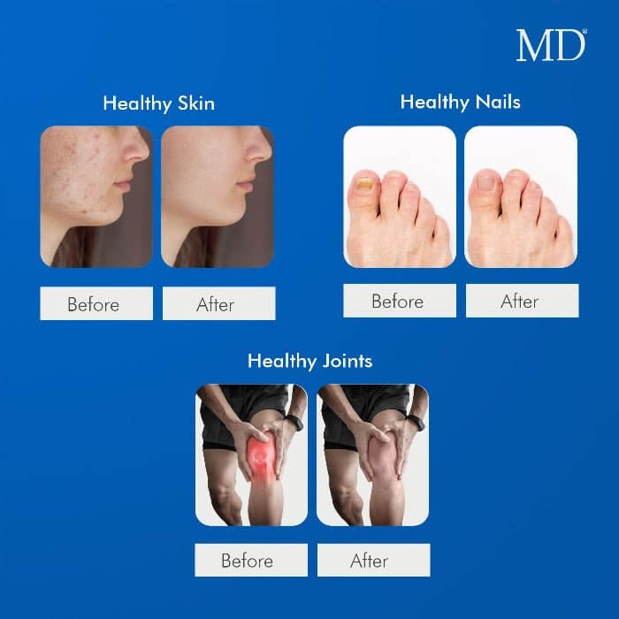 Before and after results of MD Ultimate Beauty Drink showing improved skin tone, stronger nails, and enhanced joint flexibility